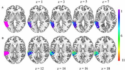 Early Phonological Neural Specialization Predicts Later Growth in Word Reading Skills